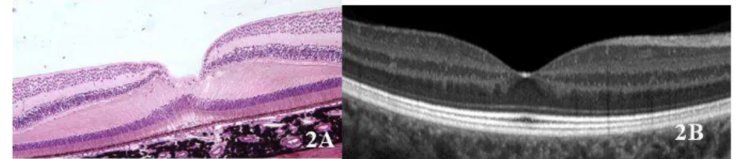Figura 2. A) Corte histológico da retina mostrando a região foveal B) SD-OCT da  região foveal