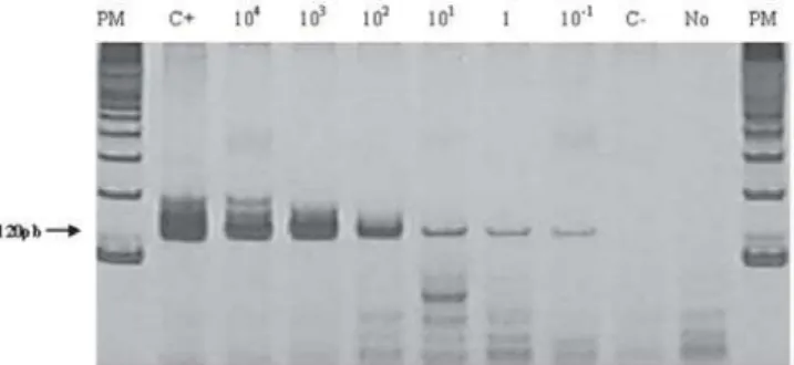 Figura 2.  Eletroforese em gel de poliacrilamida 8% corado com ni- ni-trato de prata.  Amplificação de fragmento de DNA (a) Controle  Posi-tivo contendo 10 4  formas promastigotas de Leishmania chagasi;  (b-o) de sangue periférico de cães oriundos de Poxor