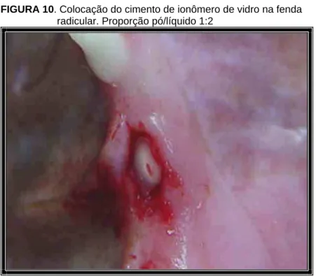 FIGURA 11. Reimplante dental, após odontossecção cervical transversal.  