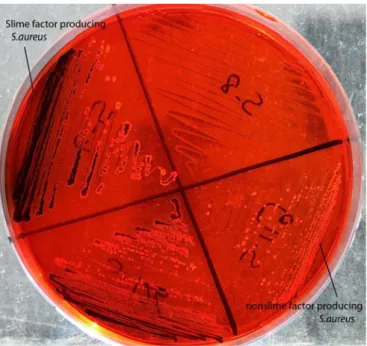 Figure 1. Slime Factor Production of S.aureus on Congo Red Agar.