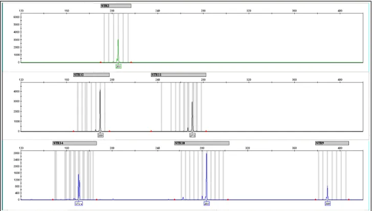 Figura  4: Exemplo da  análise,  no  GeneMapper  (Applied Biosystems), de  um dos multiplex  estudados incluindo seis  STRs