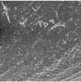 Figura 20 - Fotomicrografia obtida do terço apical após instrumentação oscilatória e  irrigação com pontas NaviTip (G1) (aumento de 500x)