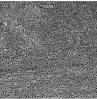 Figura 24 - Fotomicrografia obtida do terço médio após instrumentação oscilatória e  irrigação com pontas NaviTip FX (G2) (aumento de 500x)
