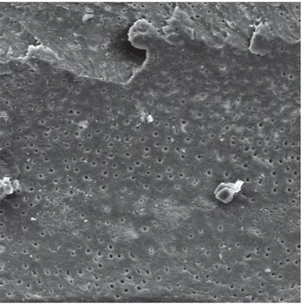 Figura 26 - Fotomicrografia obtida do terço apical após instrumentação oscilatória e  irrigação com pontas NaviTip FX (G2) (aumento de 500x)