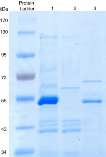 Figure  1.  SDS-PAGE  analysis  of  chitinase;  a  direct  comparison  between  Serratia  marcescens  B4A  cultured  with  different  media