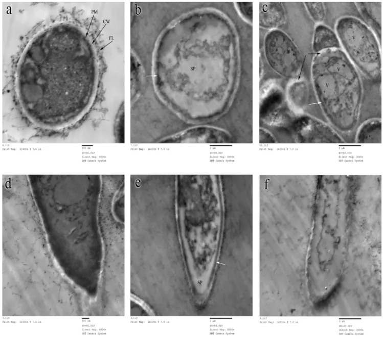 Figure 4. TEM of 10-days old A. flavus OC1 control (without AGE treatment) and sample (treated with 2.88 mg/ml of AGE)