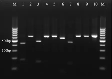 Figure 3. Restriction digestion of PCR  products of reference yeast strains with  BsiEI : Lane 1: C