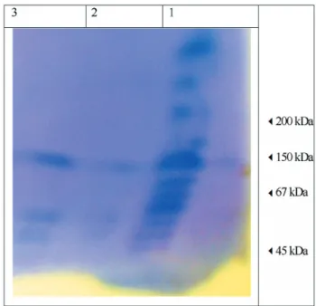 Figure 4 - Effect of pH (± SEM) on glucose aerodehydrogenase from A.