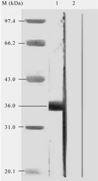 Figure 5 - Western blot analysis of EV71 and other enteroviruses. M: Pro- Pro-tein marker (kDa)