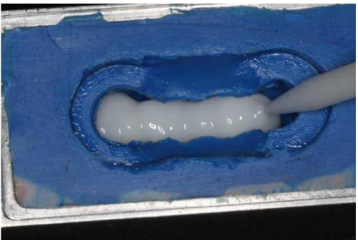 Figura 13 – Preenchimento da matriz de silicone com resina para confecção da prótese  provisória