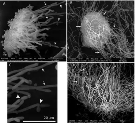 Figure 4 - Scanning electron micrographs of Candida albicans clinical strain’s morphologies embedded in extracellular material