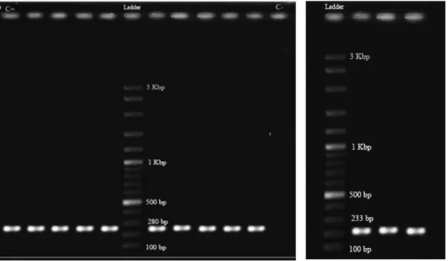 Figure 2 - PCR amplification of class 1 integron variable regions in ESBL producing Klebsiella pneumoniae isolates (Lanes 1-5 and 7-12)
