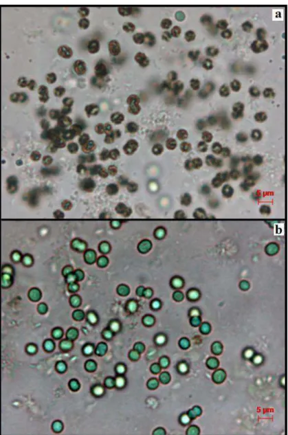 Figura 7. Colônias de Microcystis novacekii. a colônias em processo de senescência,  b  colônias  com  células  jovens