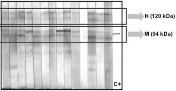 Figure 1 - Representative IB reactions for H. capsulatum antigen with se- se-rum samples obtained from individuals during an outbreak of acute  pul-monary histoplasmosis, ~60 days after the exposure