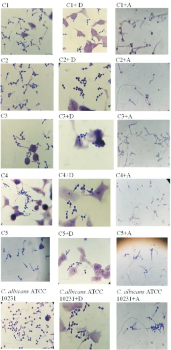 Figure 1 - Influence of sodium diclofenac (D) and aspirin(A) on Candida albicans strains morphology (0.1 mM) on HeLa line after 2 h at 37 °C.