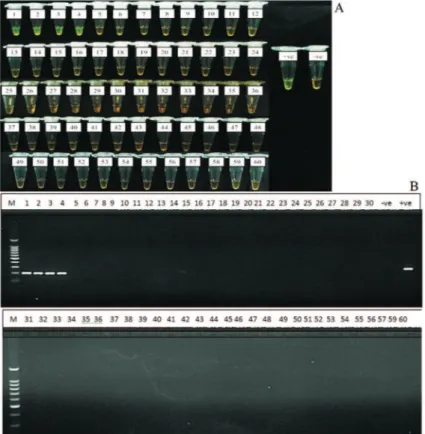 Figure 4 - Evaluation of LAMP assay on 60 clinical samples. Sample 1 to 4 were positive with both LAMP (A) and PCR (B) assays;-ve: negative control and +ve: positive control (Salmonella Typhi ATCC7251 strain).