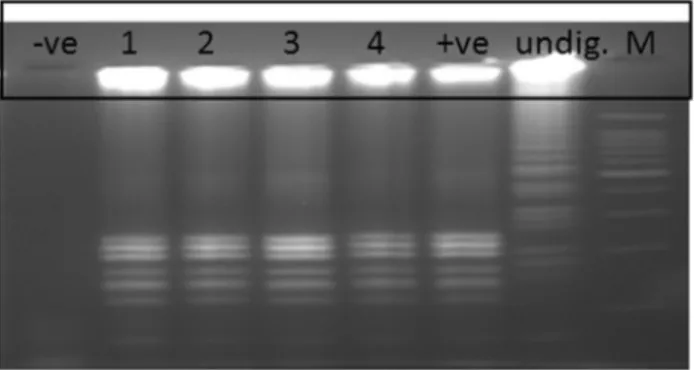 Figure 5 - Digestion of LAMP product with Hinf1 restriction en- en-zyme.-ve:Negative LAMP product; lane 1-4: Positive LAMP samples cut with HinfI enzyme; +ve: Positive control LAMP product cut with HinfI enzyme; Undig: Undigested LAMP product of positive c