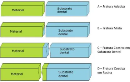 Figura 8 - Tipos de Fratura. 