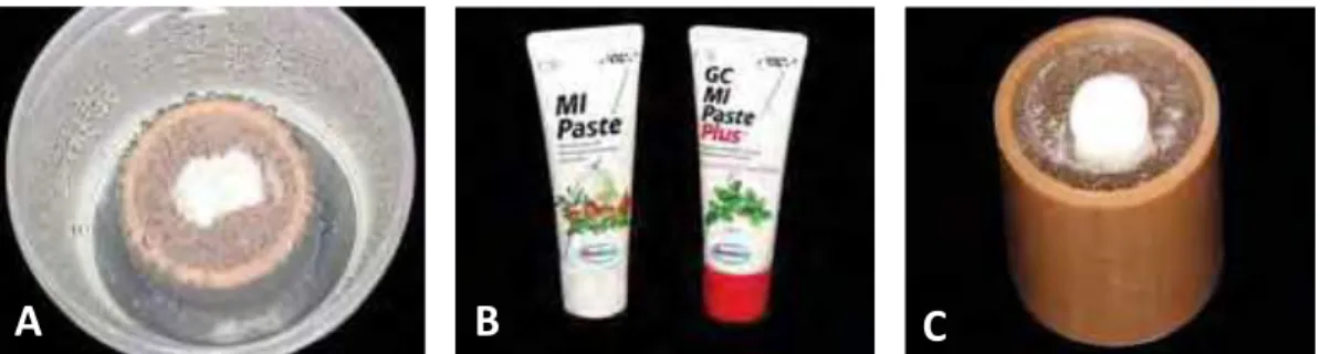 Figura 4- A) Desafio erosivo – Imersão da amostra em Sprite Zero; B) Frasco de MI  Paste e MI Paste Plus; e C) Tratamento remineralizador com MI Paste