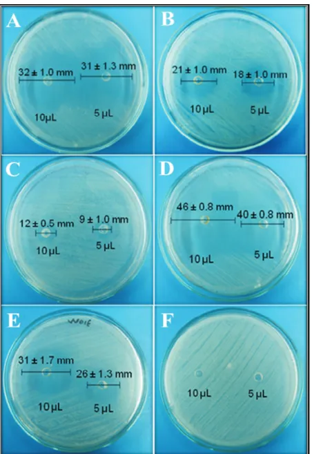 Figure 3 - Antibacterial activity of essential oils from Lippia alba on S. aureus ATCC 25923 using the agar diffusion test