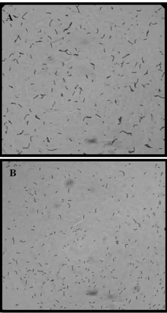 Figure 2 - Optical microscopic image (100x) of Escherichia coli (A) and Bacillus subtillis(B), stained by Gram, demonstrating high and low 