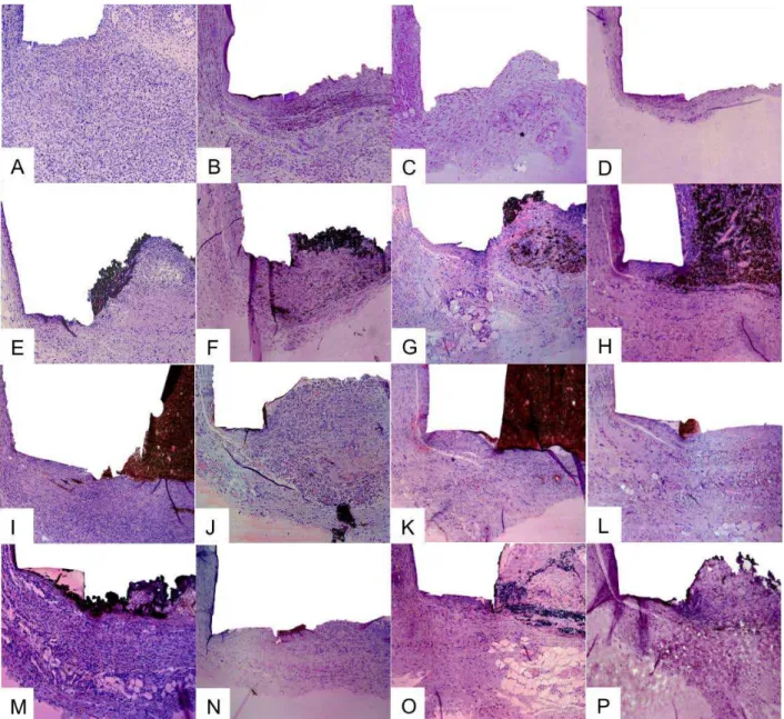 Figure 1 Subcutaneous tissue reactions in the experimental groups. Control group: (A,  B) thick fibrous capsule and moderate inflammatory reaction (7 and 15 days HE, 100x); 