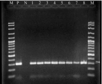 Figure 1 - An agarose gel of PCR products of H. pylori isolates from antral biopsy specimens (M: DNA Ladder (100 bp), P: H