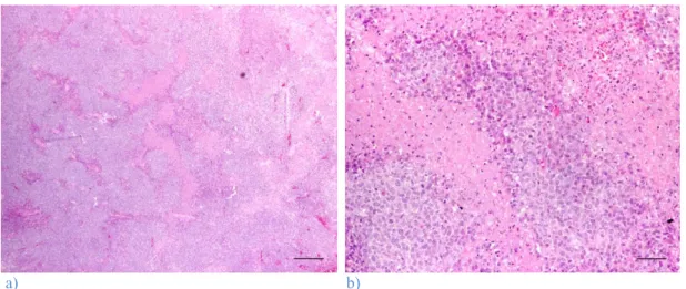 Figura 9: Extensas zonas de necrose num histiocitoma cutâneo canino do grupo histológico III: a)  Estalão= 300 µm; b) Estalão= 60 µm