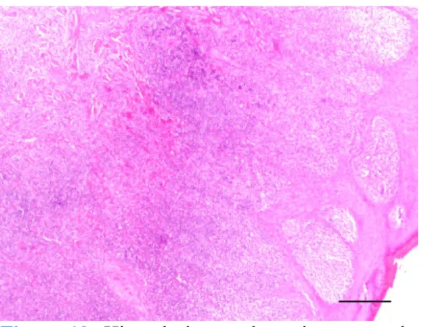 Figura 10: Hiperplasia pseudocarcinomatosa da    