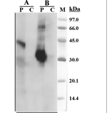 Figura 1. Immunoblotting IgE com extracto de dióspiro e com  extracto de Lolium perenne