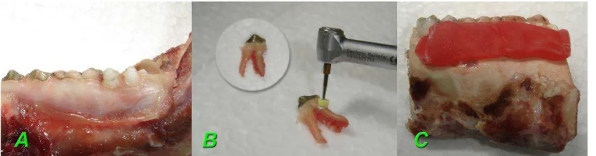Figura  1  -  Bloco  contendo  os  dentes  “A”,  Preparo  das  reabsorções  radiculares  externas  e  o  close  da  reabsorção  confeccionada  “B”