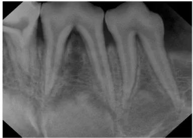 Figura  2  -  Imagem  radiográfica  dos  dentes  suínos  obtida  no  DEXIS  Digital Radiography 