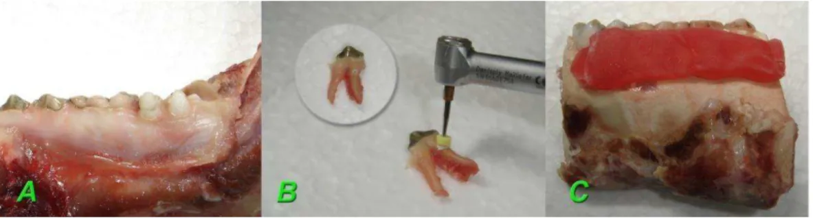 Figura  1  -  Bloco  contendo  os  dentes  “A”,  Preparo  das  reabsorções  radiculares  externas  e  o  close  da  reabsorção  confeccionada  “B”