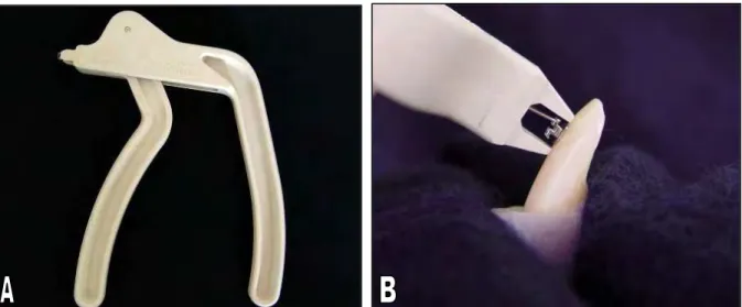 FIGURA  4  –  A)  Instrumento  de  descolagem  Lift-Off  (3M  Unitek).  B)  Gancho  metálico  do  instrumento encaixado na aleta incisal direita e ponta plástica apoiada na superfície vestibular  do dente