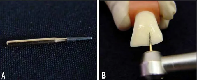 FIGURA  6  –  A)  Broca  de  carboneto  de  tungstênio  com  12  lâminas  (Beavers  Dental)