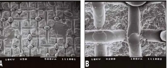 FIGURA  9  -  Eletromicrografias  da  réplica  do  Grupo  1,  após  a  remoção  do  bráquete  com  o  alicate  de  descolagem  reto/AEZ  (Ormco  Corp.)