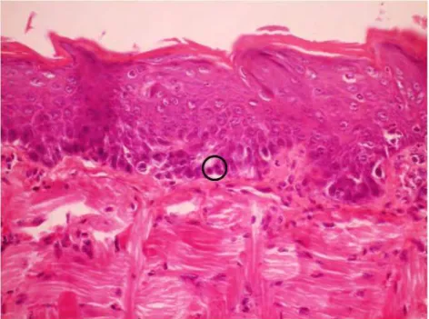Figura 16 - Corte sagital do dorso da língua do camundongo do grupo F+L-: observa-se a  presença  de  hiperplasia  epitelial,  duplicação  da  camada  basal  e  mitose  ( ○ )  e  espongiose