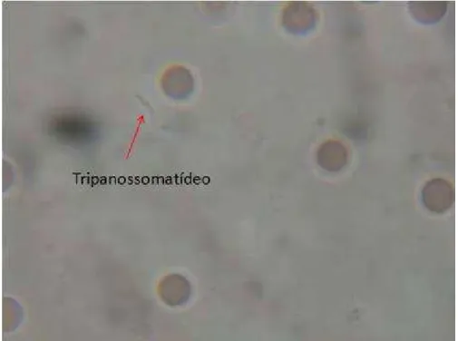Figura  2: Hemocultura de  cão, positiva  para  tripanossomatídeo  em meio  LIT (Liver Infusion  Tryptose)