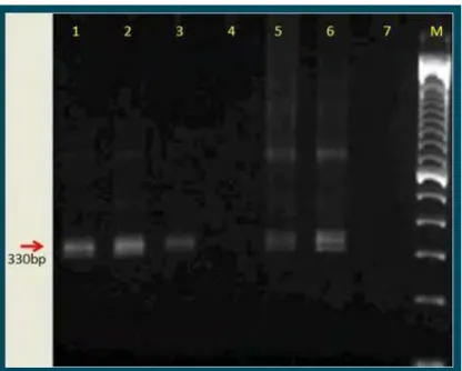 Figura  3.  Gel  de  agarose  à  1,0%  corado  com  Gelred TM .  Amplificação  dos  fragmentos  do  Trypanosoma cruzi e/ou Trypanosoma rangeli pela PCR, em cinco  amostras de hemocultura  de cães e gatos de Botucatu-SP