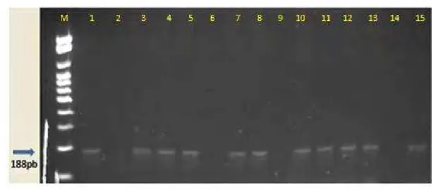 Figura 5: Gel de agarose à 1,0% corado com Gelred TM . Amplificação dos fragmentos de 188  pb do Trypanosoma cruzi pela PCR, em 13 amostras de hemocultura de gatos de  Botucatu-SP