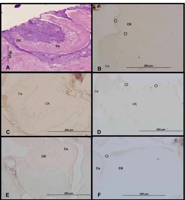 FIG 05: Fotomicrogafia da região do corpo pedunculado de indivíduos expostos ao dióxido de  carbono durante a fase de recém-emergida corado com hematoxilina e eosina (A) e marcação  através de técnica de imunohistoquímica da proteína c-Fos  no cérebro de i