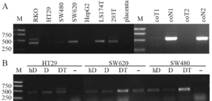 Figure 2 - Effects of DNA methylation and histone deacetylation inhibi- inhibi-tors on HERV-H4p15 transcription in cancer cells