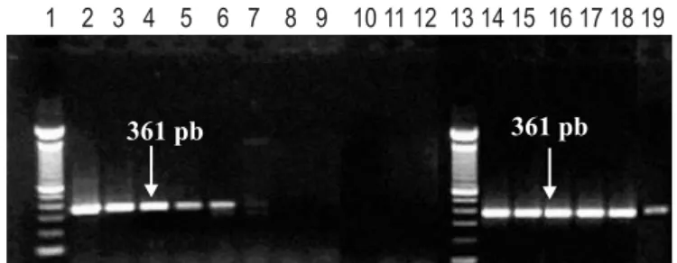 Figure 1. PCR using primers eri 1 and eri 2 (SANGARI;