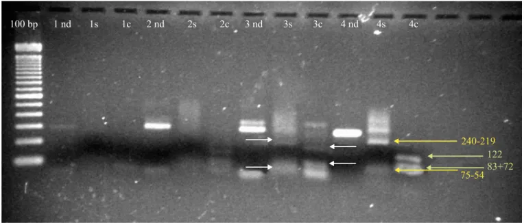 Figure 3. RFLP pattern on agarose gel electrophoresis (2%) of PCR products amplified from sputum samples (1-3) and from the ATCC 25177 M