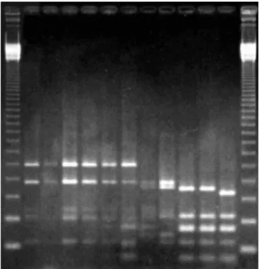 Figure 3. Agarose gel electrophoresis of amplified 16S rDNA digested with restriction endonuclease Alu I