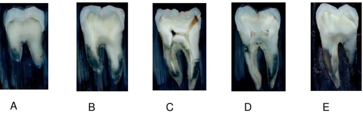 Figura 5 - Sequência de cortes do elemento dental seccionado para modelagem. 