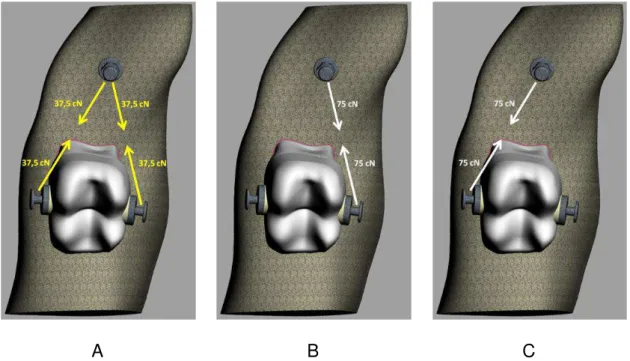 Figura 6 - Esquema de aplicação de carga para cada modelo. A - esquema de força em ambos  os  lados,  de  37,5  cN  cada;  B  -  aplicação  apenas  vestibular,  de  75  cN  cada;  C  -  aplicação  apenas lingual, de 75 cN cada