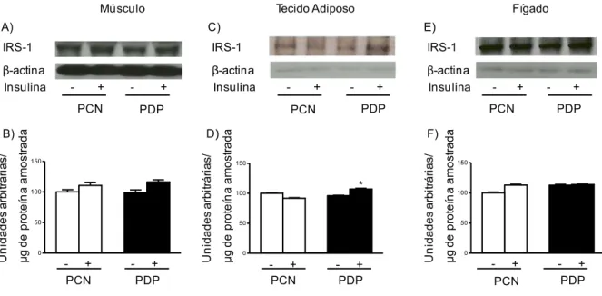 Figura  3  -  Avaliação  do  grau  de  fosforilação  em  serina  do  IRS-1  (Ser307)  antes  (-)  e  após  (+)  o  estímulo insulínico no músculo gastrocnêmio (A, B), tecido adiposo branco periepididimal (C, D) e  fígado (E, F) de proles de ratas-controle 