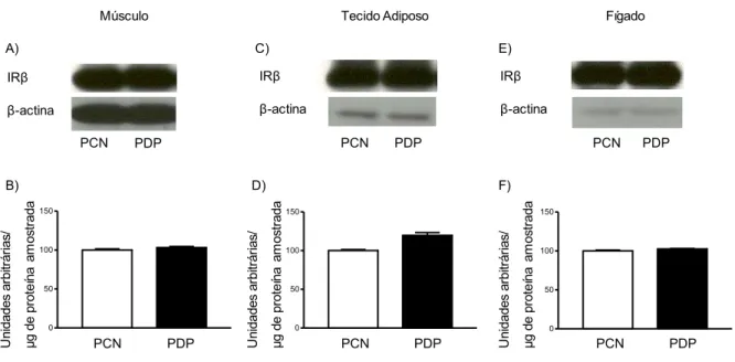 Figura 4 - Avaliação do conteúdo da subunidade β do receptor de insulina (IRβ) em tecido muscular  gastrocnêmio  (A,  B),  adiposo  branco  periepididimal  (C,  D)  e  hepático  (E,  F)  de  proles  de   ratas-controle (PCN) e de proles de ratas com doença