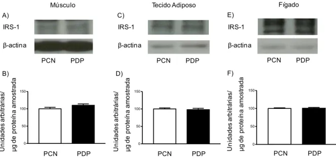 Figura 5 - Avaliação do conteúdo do IRS-1 em tecido muscular gastrocnêmio (A, B), adiposo branco  periepididimal  (C,  D)  e  hepático  (E,  F)  de  proles  de  ratas-controle  (PCN)  e  proles  de  ratas  com  doença  periodontal  (PDP)